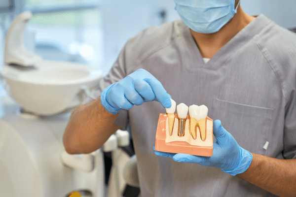 How Dental Implants Help in Restoring Quality of Life